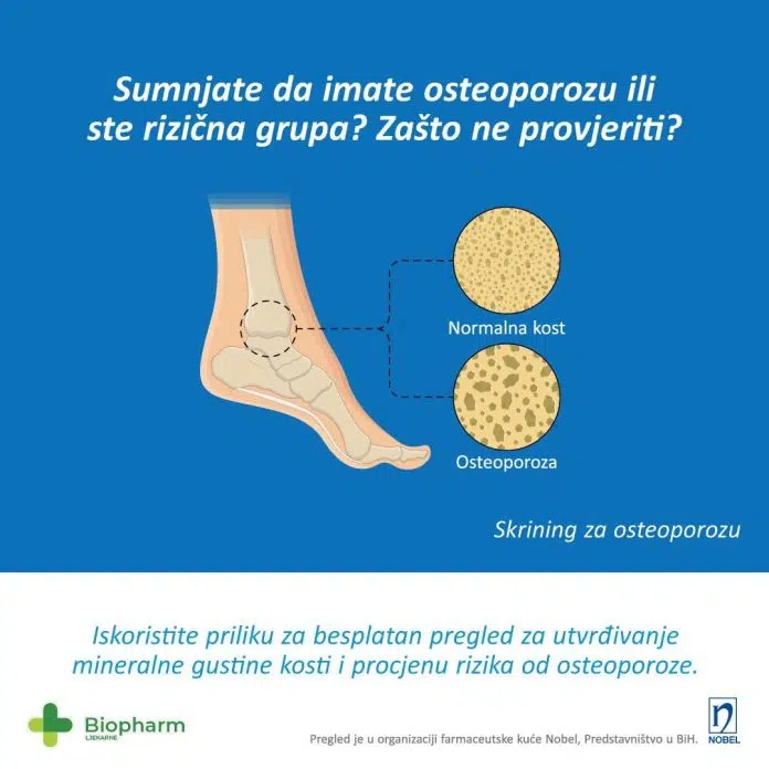 Sumnjate li da imate osteoporozu? Posjetite besplatan pregled u ljekarnama 1722521622 Sumnjate Li Da Imate Osteoporozu Posjetite Besplatan Pregled U Ljekarnama