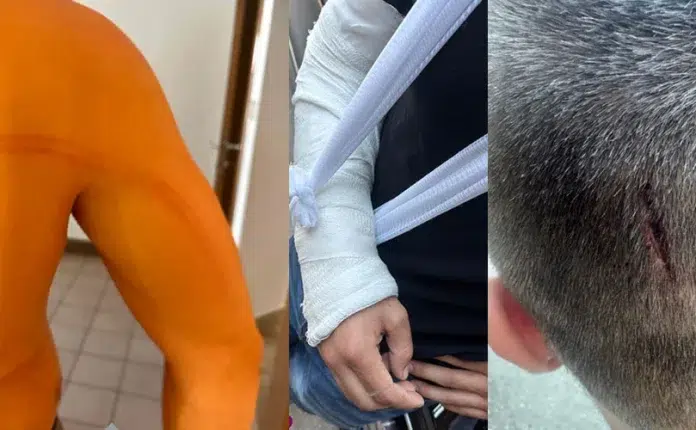 Mladići tvrde da su ih policajci brutalno tukli u Širokom Mladici Tvrde Da Su Ih Policajci Brutalno Tukli U Sirokom.webp