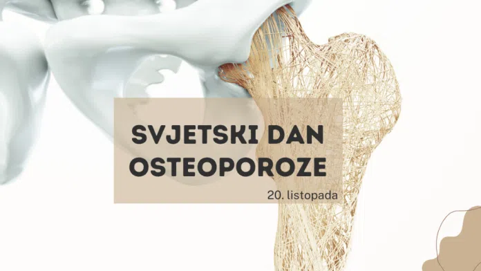 Svjetski dan osteoporoze